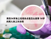 男性54岁身上出现白点是怎么回事 50岁的男人身上长白斑