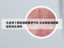 头皮得了银屑病需要透气吗 头皮银屑病需要经常洗头发吗