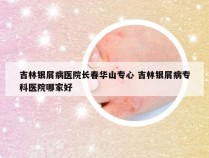 吉林银屑病医院长春华山专心 吉林银屑病专科医院哪家好