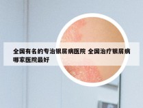 全国有名的专治银屑病医院 全国治疗银屑病哪家医院最好