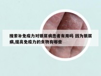 搜索补免疫力对银屑病患者有用吗 因为银屑病,提高免疫力的食物有哪些