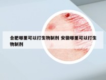 合肥哪里可以打生物制剂 安徽哪里可以打生物制剂