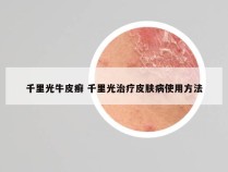 千里光牛皮癣 千里光治疗皮肤病使用方法