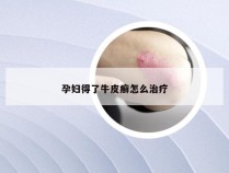孕妇得了牛皮癣怎么治疗