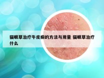 猫眼草治疗牛皮癣的方法与用量 猫眼草治疗什么