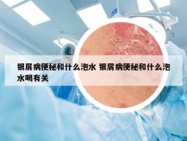 银屑病便秘和什么泡水 银屑病便秘和什么泡水喝有关