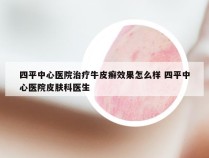 四平中心医院治疗牛皮癣效果怎么样 四平中心医院皮肤科医生