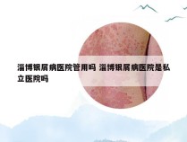 淄博银屑病医院管用吗 淄博银屑病医院是私立医院吗