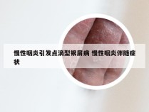 慢性咽炎引发点滴型银屑病 慢性咽炎伴随症状