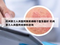 杭州第三人民医院银屑病哪个医生最好 杭州第三人民医院皮肤科咨询