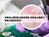 双黄连口服液能治银屑病吗 双黄连口服液与银黄口服液的区别