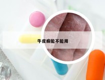 牛皮癣能不能用
