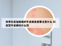 秋季红皮加脓疱的牛皮癣患者要注意什么 红皮型牛皮癣吃什么药