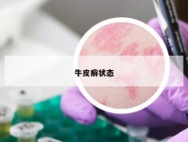 牛皮癣状态