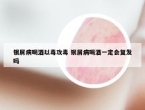 银屑病喝酒以毒攻毒 银屑病喝酒一定会复发吗