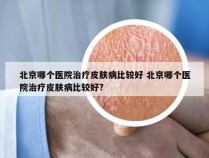 北京哪个医院治疗皮肤病比较好 北京哪个医院治疗皮肤病比较好?
