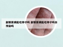 副银屑病能吃柿子吗 副银屑病能吃柿子吗会传染吗