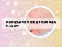 银屑病清热解毒凉血 银屑病清热解毒效果好的药有哪些