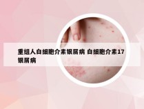 重组人白细胞介素银屑病 白细胞介素17 银屑病