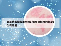 银屑病长期服用阿维a 银屑病服用阿维a多久有效果
