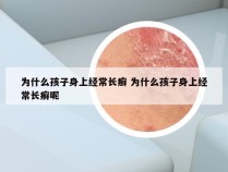 为什么孩子身上经常长癣 为什么孩子身上经常长癣呢