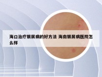 海口治疗银屑病的好方法 海南银屑病医院怎么样