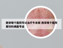 西安哪个医院可以治疗牛皮癣 西安哪个医院看妇科病最专业