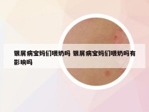 银屑病宝妈们喂奶吗 银屑病宝妈们喂奶吗有影响吗