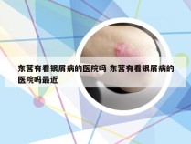 东营有看银屑病的医院吗 东营有看银屑病的医院吗最近