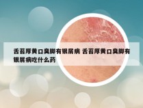 舌苔厚黄口臭脚有银屑病 舌苔厚黄口臭脚有银屑病吃什么药