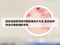 南京皮肤研究所对银屑病治疗方法 南京皮研所治疗银屑病的专家