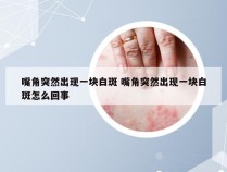 嘴角突然出现一块白斑 嘴角突然出现一块白斑怎么回事
