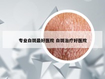 专业白斑最好医院 白斑治疗好医院