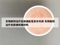 生物制剂治疗皮肤病能管多长时间 生物制剂治疗皮肤病效果好吗