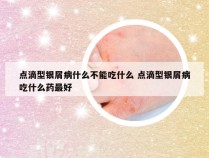 点滴型银屑病什么不能吃什么 点滴型银屑病吃什么药最好