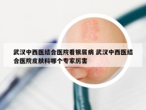 武汉中西医结合医院看银屑病 武汉中西医结合医院皮肤科哪个专家厉害