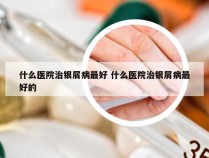 什么医院治银屑病最好 什么医院治银屑病最好的