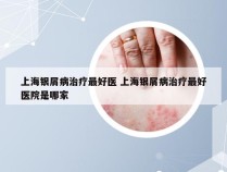 上海银屑病治疗最好医 上海银屑病治疗最好医院是哪家