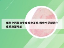 哪些中药能治牛皮癣泡茶喝 哪些中药能治牛皮癣泡茶喝的