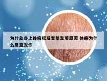 为什么身上体癣反反复复发着原因 体癣为什么反复发作