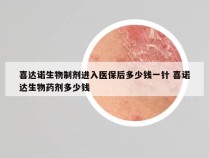 喜达诺生物制剂进入医保后多少钱一针 喜诺达生物药剂多少钱