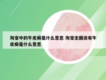 淘宝中的牛皮癣是什么意思 淘宝主图说有牛皮癣是什么意思
