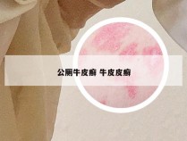 公厕牛皮癣 牛皮皮癣
