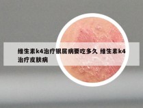 维生素k4治疗银屑病要吃多久 维生素k4治疗皮肤病