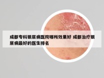 成都专科银屑病医院哪所效果好 成都治疗银屑病最好的医生排名