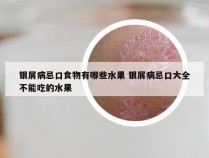 银屑病忌口食物有哪些水果 银屑病忌口大全不能吃的水果