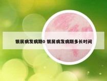 银屑病发病期0 银屑病发病期多长时间