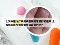 上海中医治疗银屑病医院哪家最好的医院 上海哪家医院治疗银屑病最好的地方