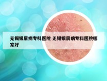 无锡银屑病专科医院 无锡银屑病专科医院哪家好