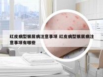 红皮病型银屑病注意事项 红皮病型银屑病注意事项有哪些